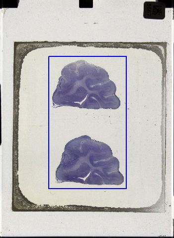 Media type: image; Special Collections 3043   shows specimen_part histological serial section;